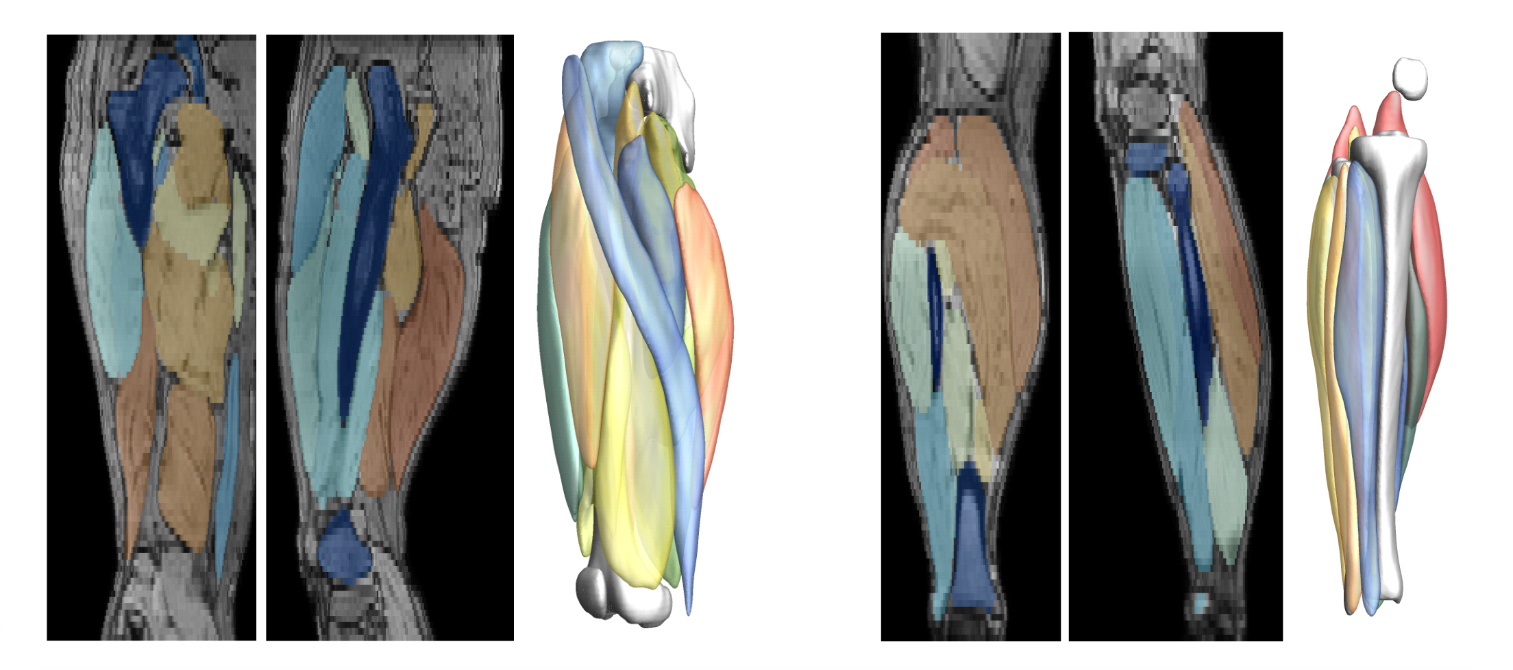 Example segmentations of the thigh and leg automated segmention UNET neural networks.